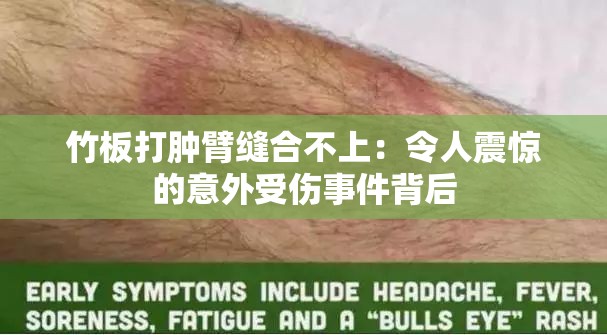 竹板打肿臂缝合不上：令人震惊的意外受伤事件背后