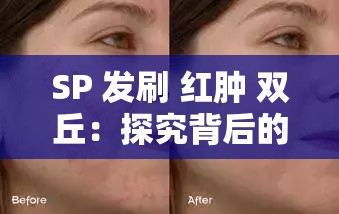 SP 发刷 红肿 双丘：探究背后的原因及解决办法