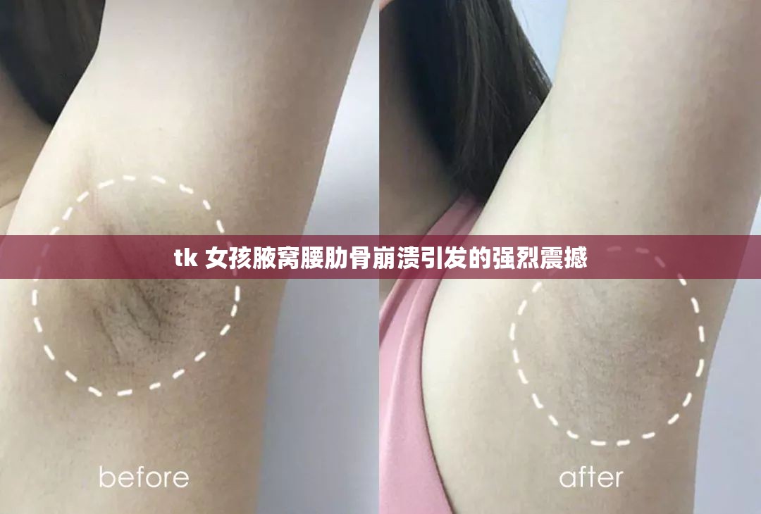 tk 女孩腋窝腰肋骨崩溃引发的强烈震撼