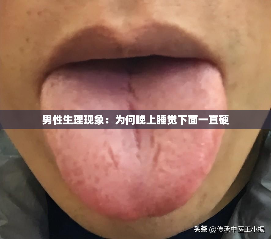 男性生理现象：为何晚上睡觉下面一直硬