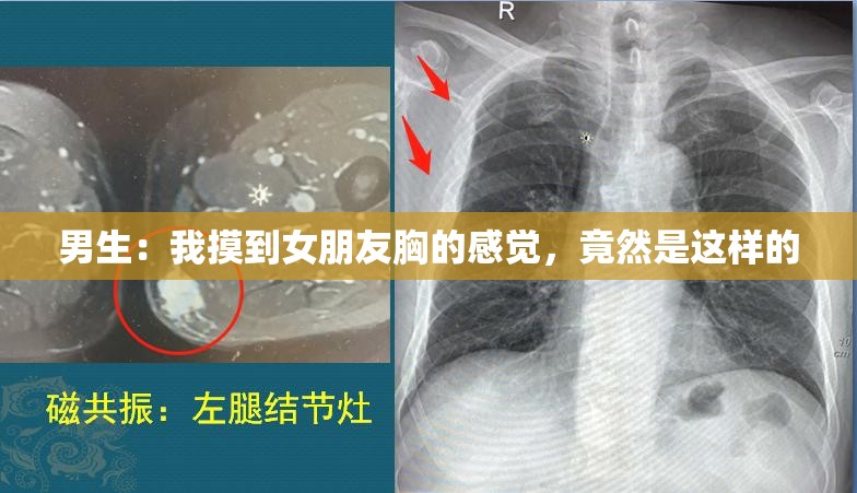 男生：我摸到女朋友胸的感觉，竟然是这样的