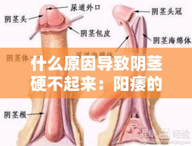 什么原因导致阴茎硬不起来：阳痿的背后到底隐藏着哪些秘密