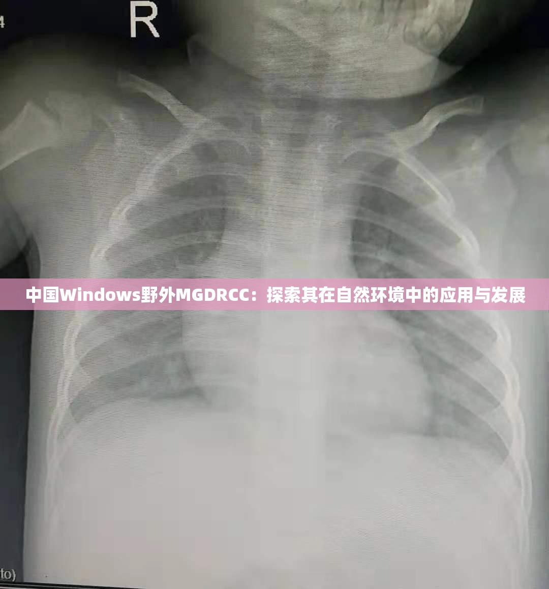 中国Windows野外MGDRCC：探索其在自然环境中的应用与发展