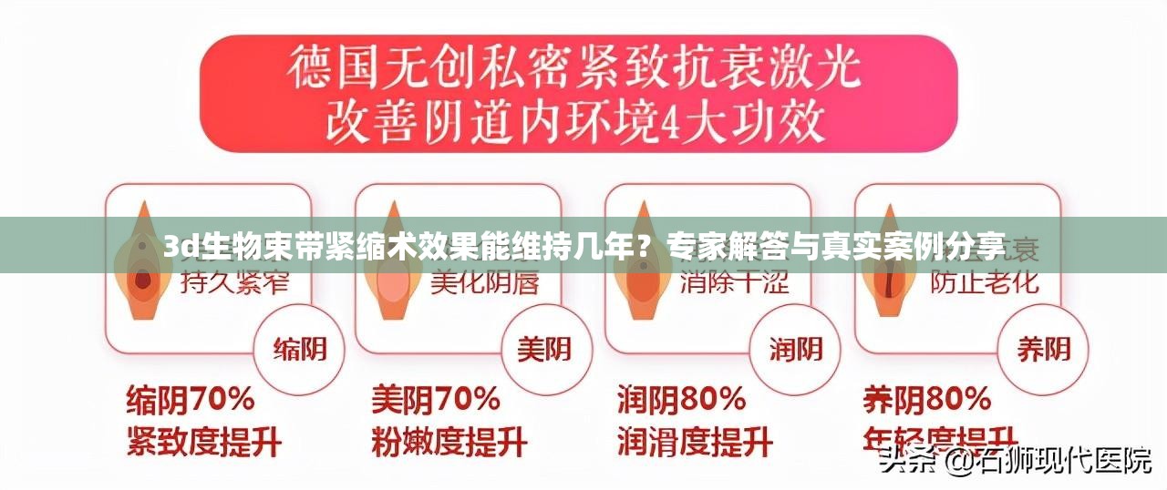 3d生物束带紧缩术效果能维持几年？专家解答与真实案例分享